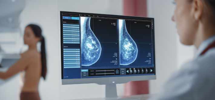AI bidrar i kampen mot bröstcancer
